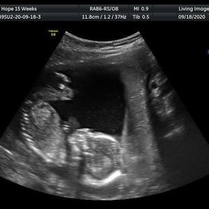 Meet your Posher, Hope